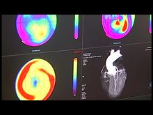 Импульс-ТВ: Томограф в Великолукской городской больнице