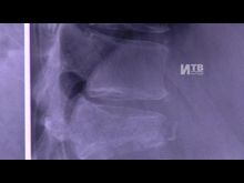 Импульс-ТВ: Сосудистое отделение ЦГБ