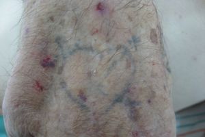 В Великих Луках устанавливается личность мужчины (фото)