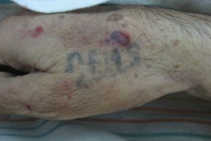 В Великих Луках устанавливается личность мужчины (фото)